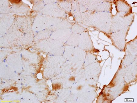 Immunohistochemistry (Formalin/PFA-fixed paraffin-embedded sections) - Anti-CACNA1S antibody (AB203662)