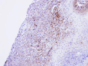Immunohistochemistry (Formalin/PFA-fixed paraffin-embedded sections) - Anti-CACNA1S antibody (AB96413)