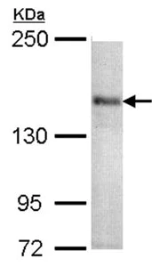 Western blot - Anti-CACNA1S antibody (AB96413)