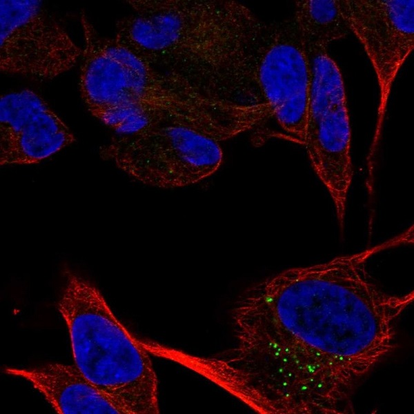 Immunocytochemistry/ Immunofluorescence - Anti-CACNA2D2 antibody (AB221865), expandable thumbnail