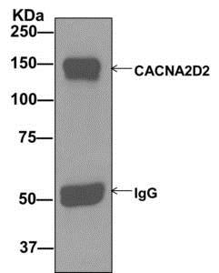 Immunoprecipitation - Anti-CACNA2D2 antibody [EPR12343] (AB173293), expandable thumbnail