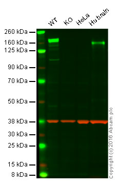 Western blot - Anti-CACNA2D2 antibody [EPR12343] (AB173293), expandable thumbnail