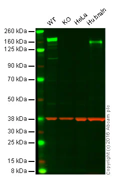Western blot - Anti-CACNA2D2 antibody [EPR12343] (AB173293)
