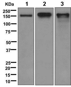 Western blot - Anti-CACNA2D2 antibody [EPR12343] (AB173293), expandable thumbnail