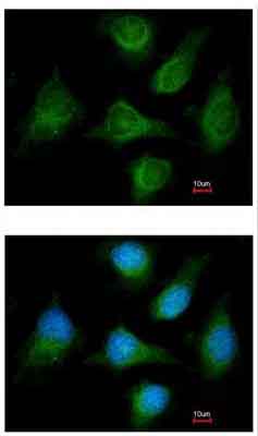 Immunocytochemistry/ Immunofluorescence - Anti-CACNB1/CAB1 antibody (AB155179), expandable thumbnail