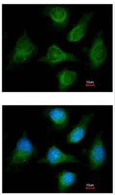 Immunocytochemistry/ Immunofluorescence - Anti-CACNB1/CAB1 antibody (AB155179)