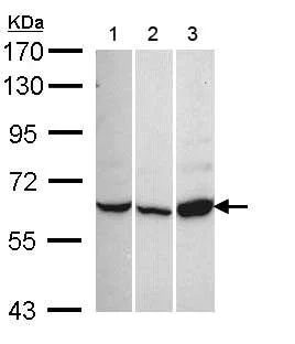 Western blot - Anti-CACNB1/CAB1 antibody (AB155179)