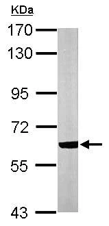 Western blot - Anti-CACNB1/CAB1 antibody (AB155179)