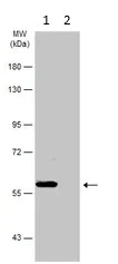 Western blot - Anti-CACNB1/CAB1 antibody (AB155179)