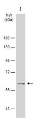 Western blot - Anti-CACNB1/CAB1 antibody (AB155179)