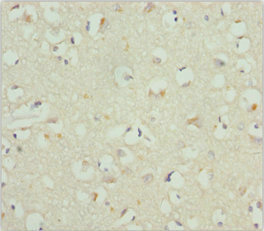 Immunohistochemistry (Formalin/PFA-fixed paraffin-embedded sections) - Anti-CACNB1/CAB1 antibody (AB230019)