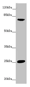 Western blot - Anti-CACNB1/CAB1 antibody (AB230019)