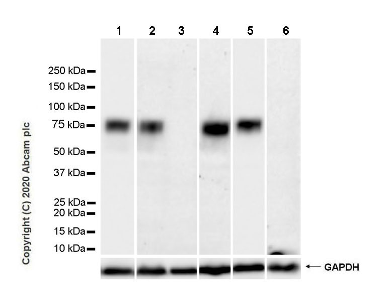 Western blot - Anti-CACNB2 antibody [EPR23419-58] (AB253193), expandable thumbnail
