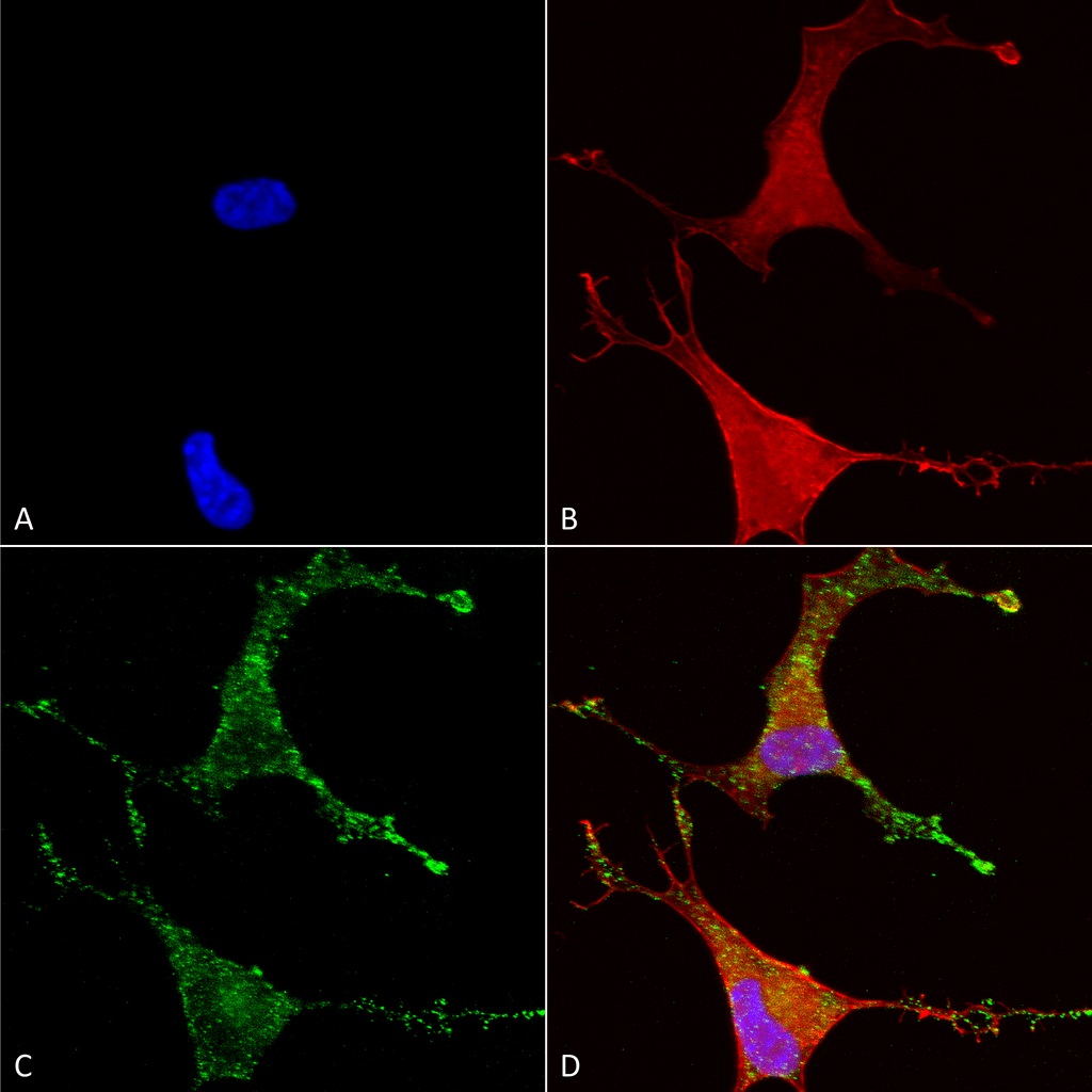 Immunocytochemistry/ Immunofluorescence - Anti-CACNB2 antibody [N8B/1] (AB93606), expandable thumbnail