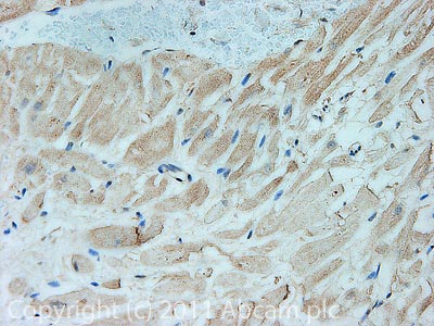 Immunohistochemistry (Formalin/PFA-fixed paraffin-embedded sections) - Anti-CACNB2 antibody [N8B/1] (AB93606), expandable thumbnail