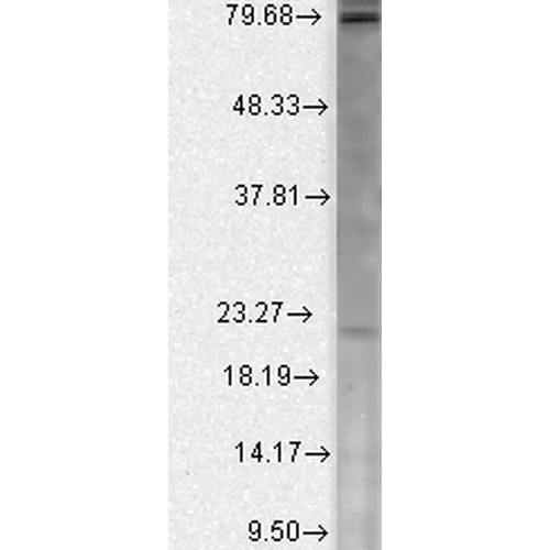 Western blot - Anti-CACNB2 antibody [N8B/1] (AB93606)