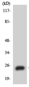 Western blot - Anti-CACNG1 antibody (AB135994), expandable thumbnail