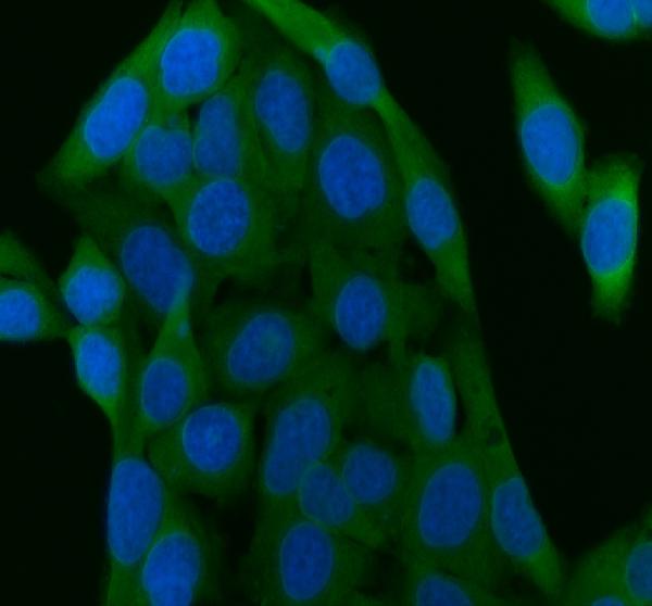 Immunocytochemistry/ Immunofluorescence - Anti-CacyBP antibody (AB190950)