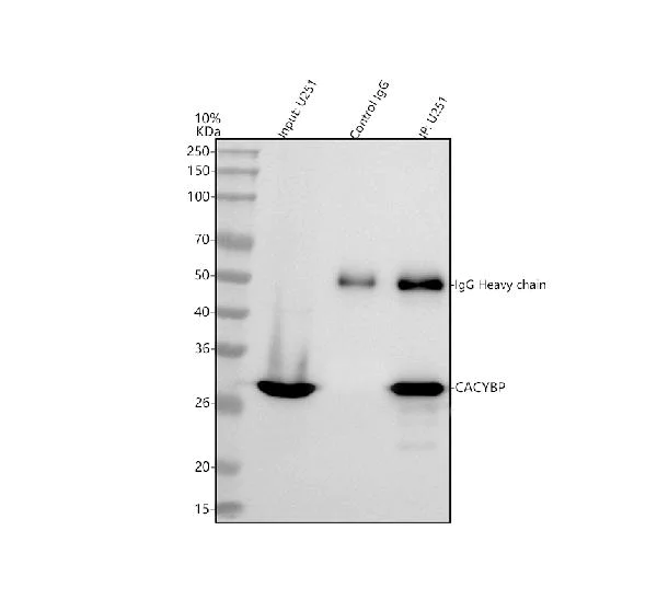 Immunoprecipitation - Anti-CacyBP antibody (AB190950)