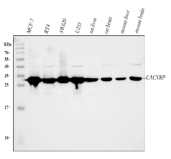 Western blot - Anti-CacyBP antibody (AB190950)