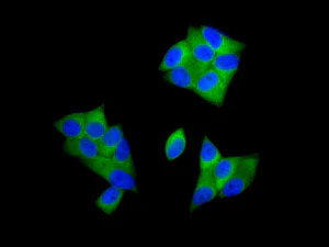 Immunocytochemistry/ Immunofluorescence - Anti-CacyBP antibody [EPR12374] (AB171972)