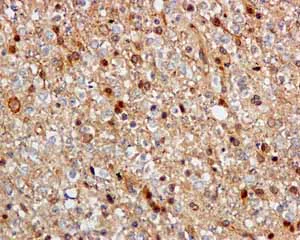Immunohistochemistry (Formalin/PFA-fixed paraffin-embedded sections) - Anti-CacyBP antibody [EPR12374] (AB171972)