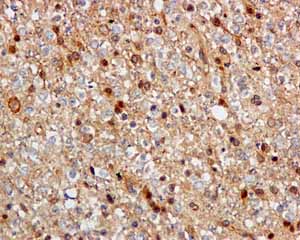Immunohistochemistry (Formalin/PFA-fixed paraffin-embedded sections) - Anti-CacyBP antibody [EPR12374] - BSA and Azide free (AB249684)