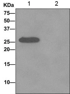 Immunoprecipitation - Anti-CacyBP antibody [EPR12374] - BSA and Azide free (AB249684)