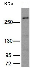 Western blot - Anti-CAD antibody (AB97340)