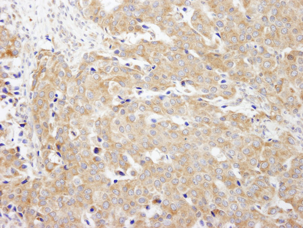 Immunohistochemistry (Formalin/PFA-fixed paraffin-embedded sections) - Anti-CAD antibody (AB99312), expandable thumbnail
