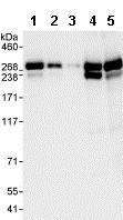 Western blot - Anti-CAD antibody (AB99312), expandable thumbnail
