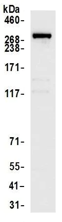 Immunoprecipitation - Anti-CAD antibody (AB99313)