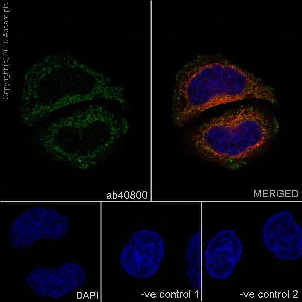 Immunocytochemistry/ Immunofluorescence - Anti-CAD antibody [EP710Y] - BSA and Azide free (AB231694)