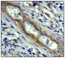Immunohistochemistry (Formalin/PFA-fixed paraffin-embedded sections) - Anti-CAD antibody [EP711Y] (AB40765)