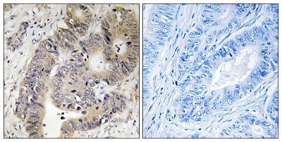 Immunohistochemistry (Formalin/PFA-fixed paraffin-embedded sections) - Anti-CAD (phospho T456) antibody (AB194534)