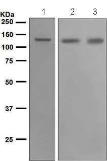 Western blot - Anti-cadherin 10 antibody [EPR5115] - BSA and Azide free (AB248697)