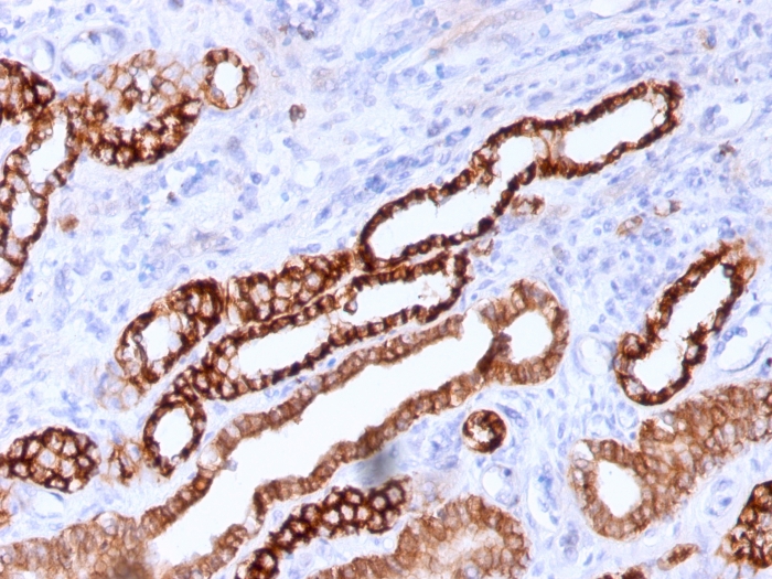 Immunohistochemistry (Formalin/PFA-fixed paraffin-embedded sections) - Anti-Cadherin 16 antibody [CDH16/1071] (AB215769)