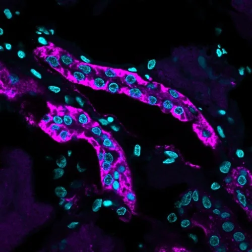 Immunohistochemistry (Formalin/PFA-fixed paraffin-embedded sections) - Anti-Cadherin 16 antibody [CDH16/1071] (AB215769)