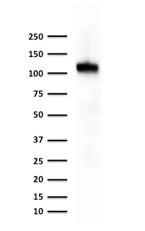 Western blot - Anti-Cadherin 16 antibody [CDH16/1071] (AB215769)