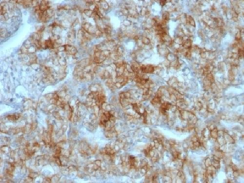 Immunohistochemistry (Formalin/PFA-fixed paraffin-embedded sections) - Anti-Cadherin 16 antibody [CDH16/1071] - BSA and Azide free (AB212243), expandable thumbnail
