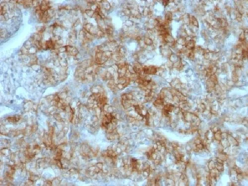 Immunohistochemistry (Formalin/PFA-fixed paraffin-embedded sections) - Anti-Cadherin 16 antibody [CDH16/1071] - BSA and Azide free (AB212243)