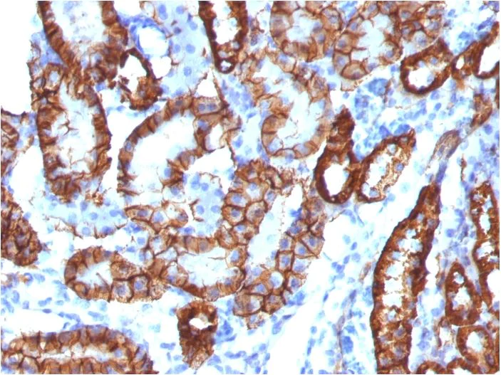 Immunohistochemistry (Formalin/PFA-fixed paraffin-embedded sections) - Anti-Cadherin 16 antibody [CDH16/1532R] (AB270263)