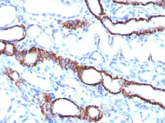 Immunohistochemistry (Formalin/PFA-fixed paraffin-embedded sections) - Anti-Cadherin 16 antibody [CDH16/1532R] (AB270263)