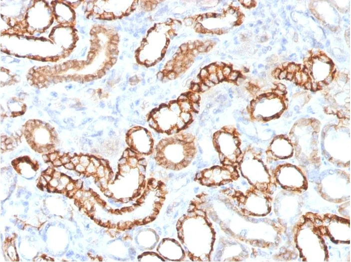 Immunohistochemistry (Formalin/PFA-fixed paraffin-embedded sections) - Anti-Cadherin 16 antibody [CDH16/1532R] (AB270263)