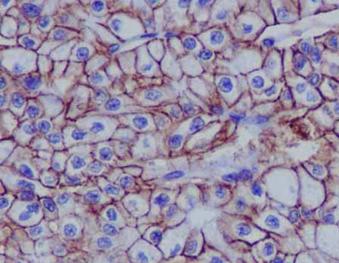 Immunohistochemistry (Formalin/PFA-fixed paraffin-embedded sections) - Anti-Cadherin 16 antibody [EPR13090] (AB183745)