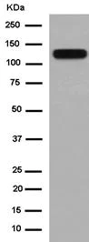 Western blot - Anti-Cadherin 16 antibody [EPR13090] (AB183745)
