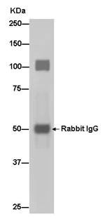 Immunoprecipitation - Anti-Cadherin 16 antibody [EPR13090] - BSA and Azide free (AB214092)