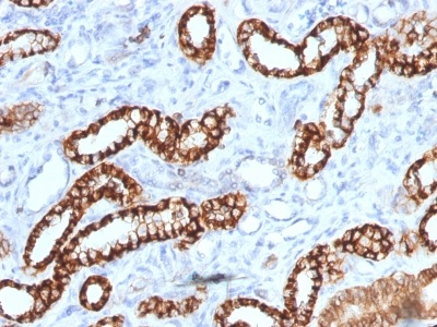 Immunohistochemistry (Formalin/PFA-fixed paraffin-embedded sections) - Anti-Cadherin 16 antibody [rCDH16/1071] (AB234411)
