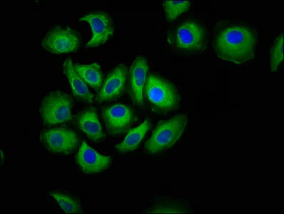 Immunocytochemistry/ Immunofluorescence - Anti-Cadherin 7 antibody (AB237754)