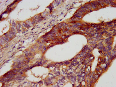 Immunohistochemistry (Formalin/PFA-fixed paraffin-embedded sections) - Anti-Cadherin 7 antibody (AB237754)